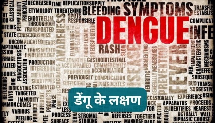 डेंगू के लक्षण